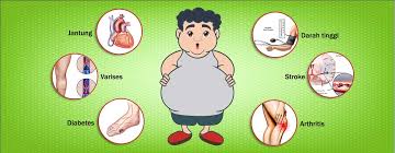 Faktor Penyebab Obesitas Serta Akibatnya